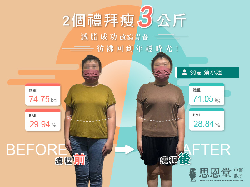高雄中醫埋線費用