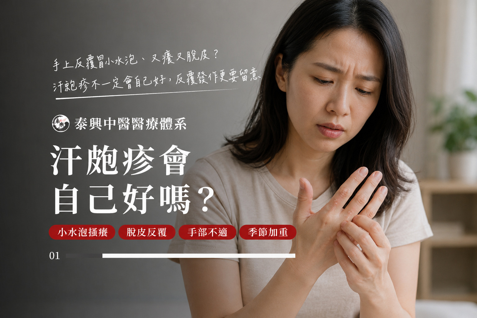 汗皰疹會自己好嗎