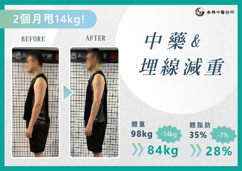 看中醫減肥