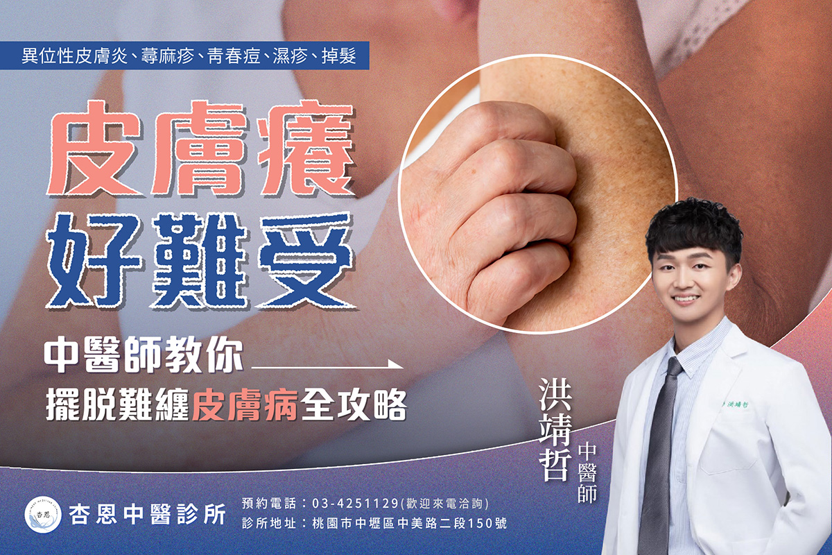 快速止癢方法