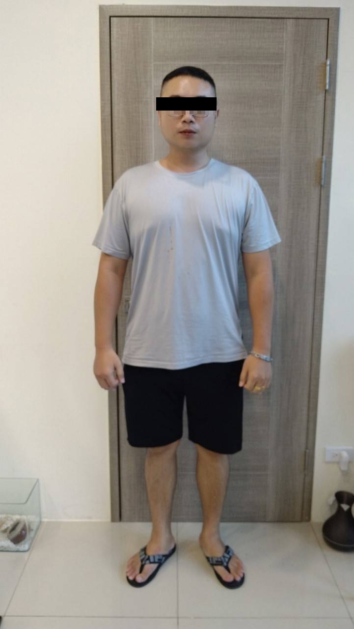 高雄減重中醫推薦