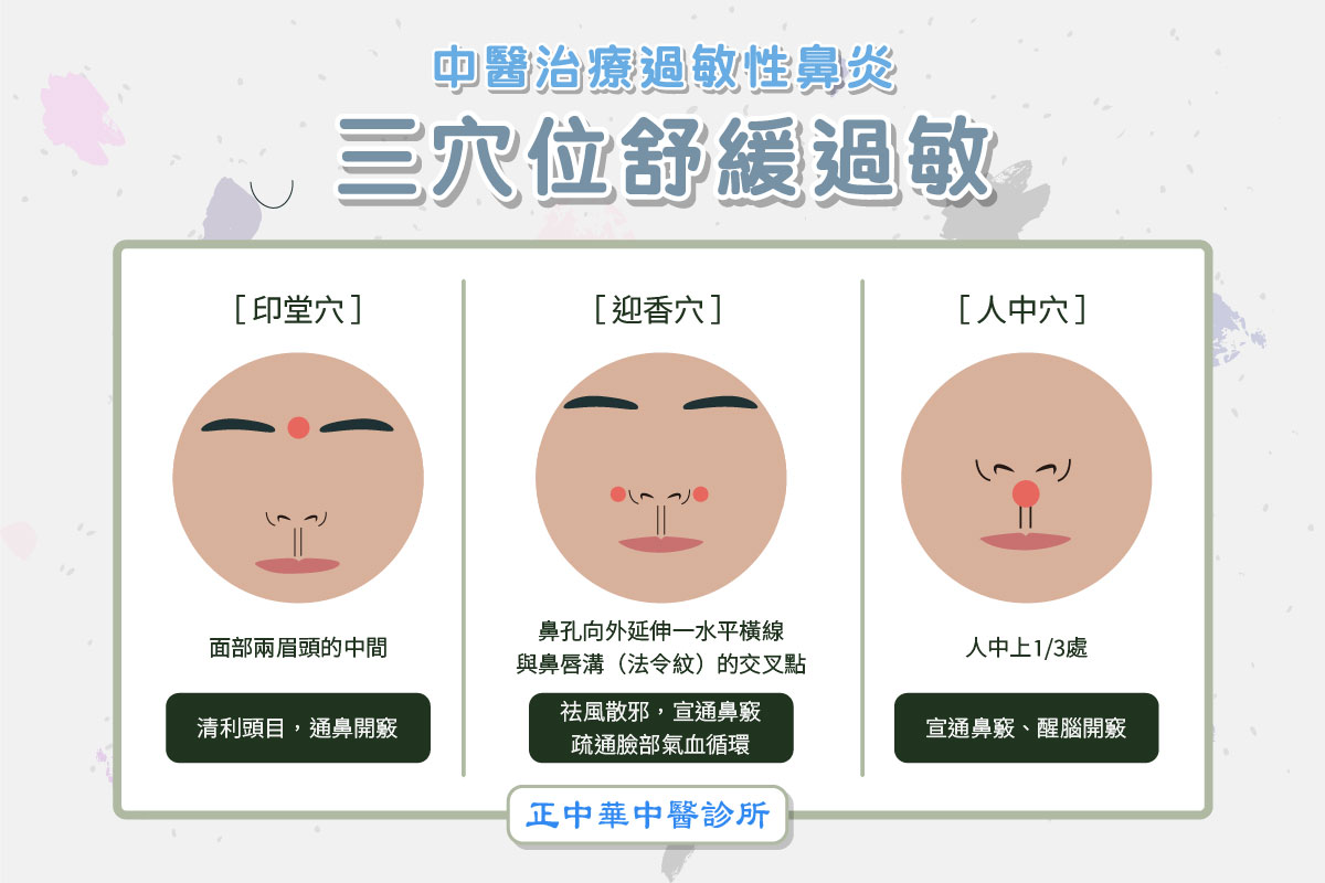 頭份鼻過敏中醫